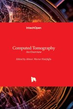Computed Tomography - An Overview