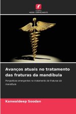 Avanços atuais no tratamento das fraturas da mandíbula