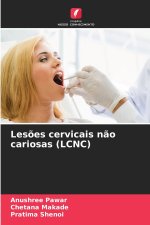 Lesões cervicais não cariosas (LCNC)