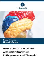 Neue Fortschritte bei der Alzheimer-Krankheit