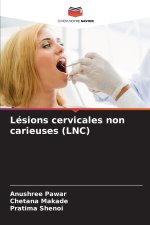 Lésions cervicales non carieuses (LNC)