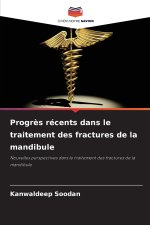 Progrès récents dans le traitement des fractures de la mandibule