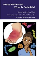 Nurse Florence®, What is Cellulitis?