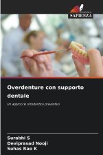 Overdenture con supporto dentale