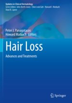Hair Loss