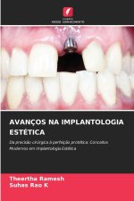 AVANÇOS NA IMPLANTOLOGIA ESTÉTICA