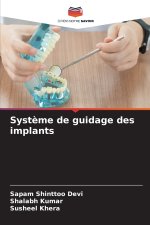 Système de guidage des implants