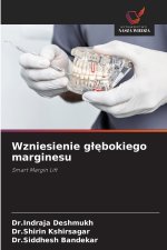Wzniesienie g¿¿bokiego marginesu
