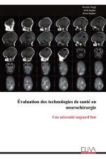 Évaluation des technologies de santé en neurochirurgie