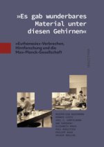'Es gab wunderbares Material unter diesen Gehirnen'