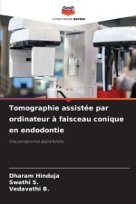 Tomographie assistée par ordinateur à faisceau conique en endodontie