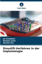 Sinuslift-Verfahren in der Implantologie