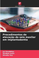Procedimentos de elevação do seio maxilar em implantodontia