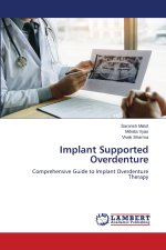 Implant Supported Overdenture
