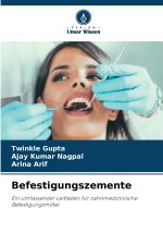 Befestigungszemente