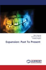 Expansion