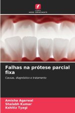 Falhas na prótese parcial fixa
