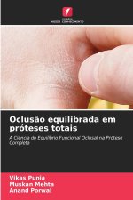 Oclusão equilibrada em próteses totais