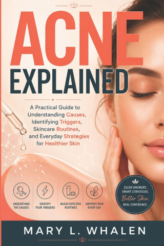 Acne Explained