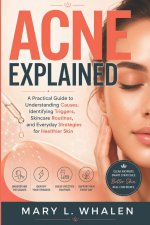 Acne Explained