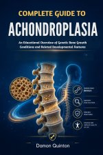 Complete Guide To Achondroplasia