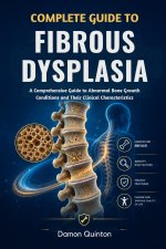 Complete Guide To Fibrous Dysplasia