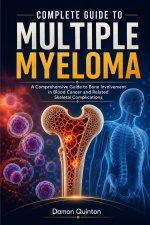 Complete Guide To Multiple Myeloma