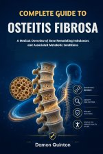 Complete Guide To Osteitis Fibrosa