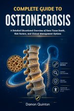 Complete Guide To Osteonecrosis