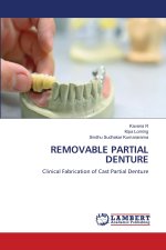 REMOVABLE PARTIAL DENTURE