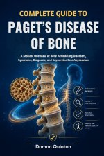 Complete Guide To Paget's Disease Of Bone