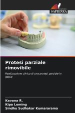 Protesi parziale rimovibile