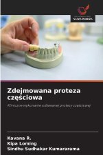 Zdejmowana proteza częściowa