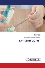 Dental implants