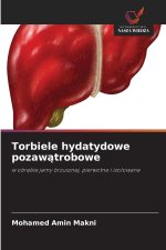 Torbiele hydatydowe pozawątrobowe