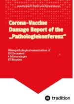 Corona-Vaccine Damage Report of the 