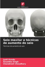 Seio maxilar e técnicas de aumento do seio
