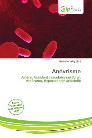 Anévrisme