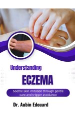 Understanding Eczema