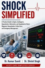 Shock Simplified