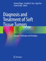Diagnosis and Treatment of Soft Tissue Tumors