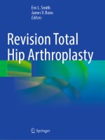 Revision Total Hip Arthroplasty
