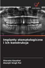 Implanty stomatologiczne i ich konstrukcja
