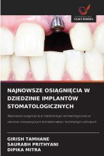 NAJNOWSZE OSIĄGNIĘCIA W DZIEDZINIE IMPLANTÓW STOMATOLOGICZNYCH
