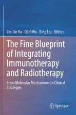 The Fine Blueprint of Integrating Immunotherapy and Radiotherapy