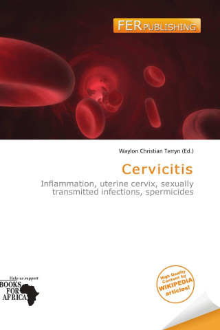 Cervicitis