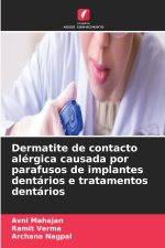 Dermatite de contacto alérgica causada por parafusos de implantes dentários e tratamentos dentários