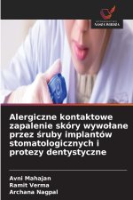 Alergiczne kontaktowe zapalenie skóry wywołane przez śruby implantów stomatologicznych i protezy dentystyczne