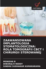 ZAAWANSOWANA IMPLANTOLOGIA STOMATOLOGICZNA
