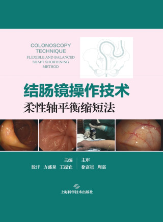 Colonoscopy Operating Technique